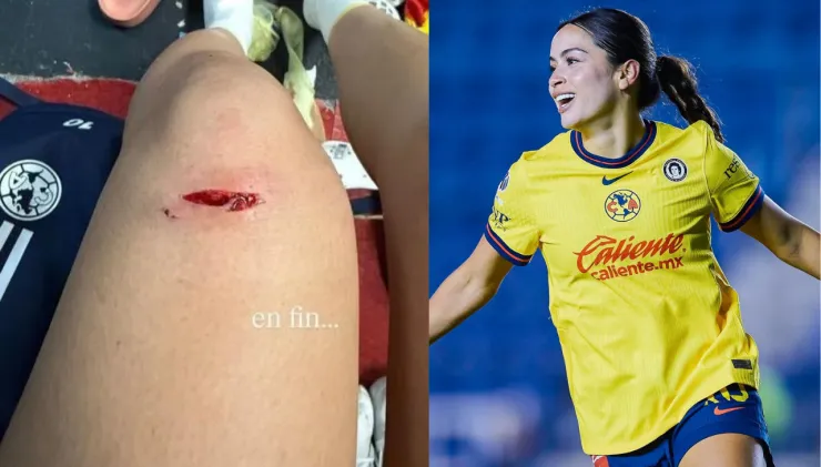 Lesión Scarlett Camberos en América