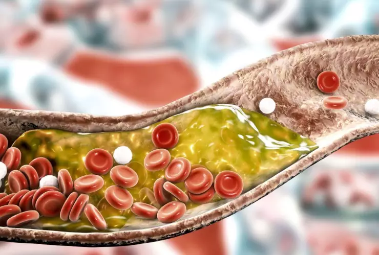 Tratamiento contra el colesterol