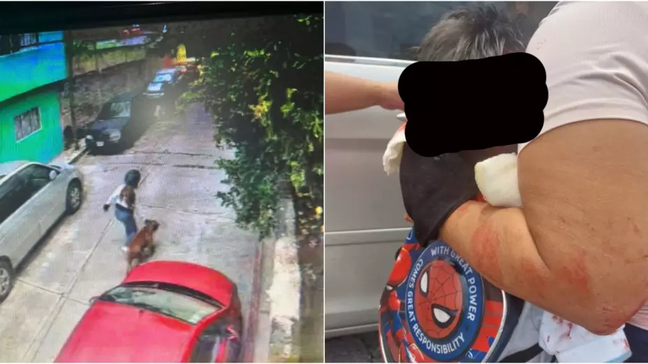 Perro pitbull ataca a niño en Jiutepec Morelos