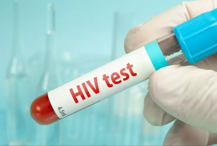 Mano de muestra de sangre para la prueba de VIH en un fondo azul de laboratorio.