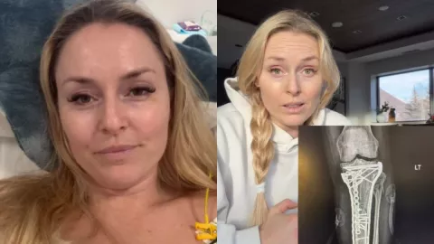 lindsey-vonn-volvio-competir-alto-rendimiento-se-rompio-rodilla-casi-amputan-pierna
