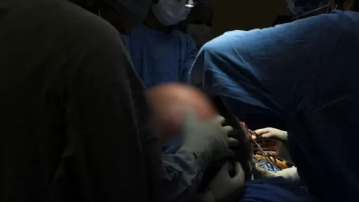 Extirpa tumor ovárico de casi 23 kilogramos en Querétaro