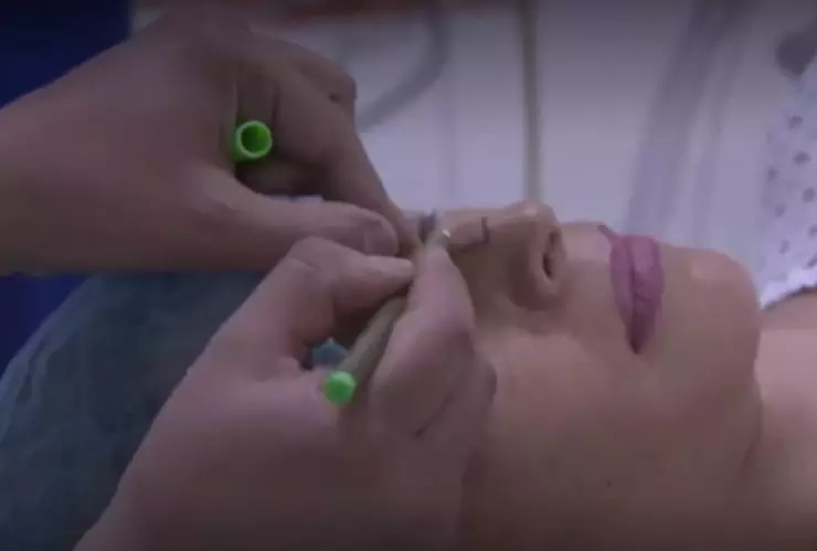 Cirugías estéticas