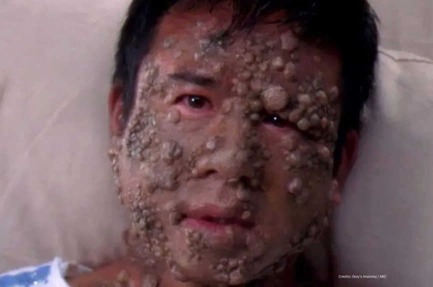 Greys-Anatomy-Casos-raros-y-reales