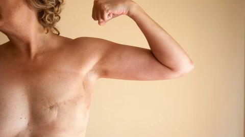 1% de mujeres que murieron por cáncer de mama tenía entre 15 a 29 años