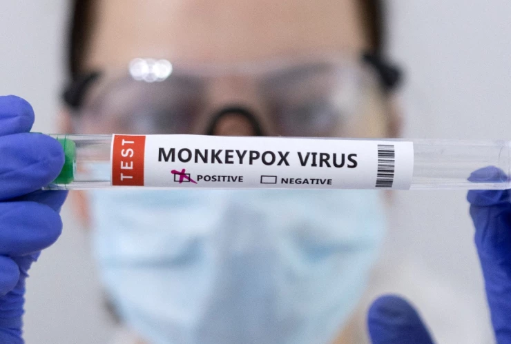 viruela del mono primera muerte brasil