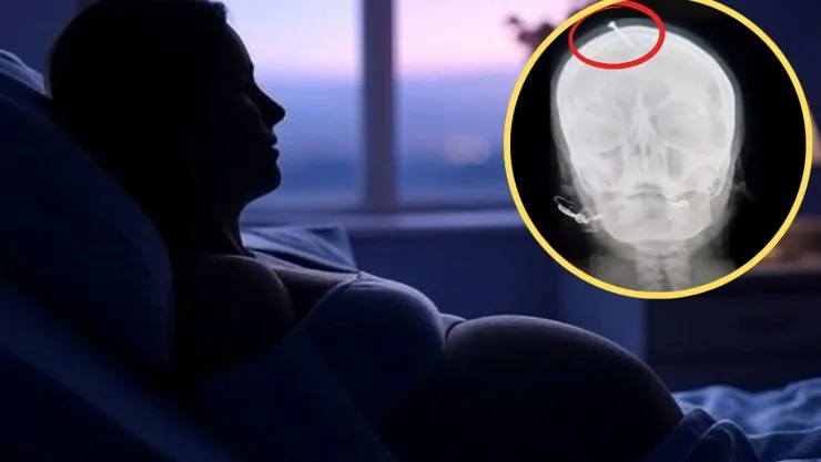 Clavan la cabeza a mujer embarazada