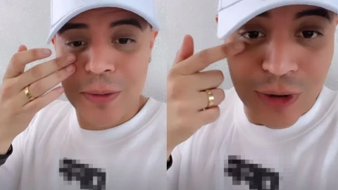 VIDEO¿Qué le pasó Aparece Eduin Caz con moretones en la cara