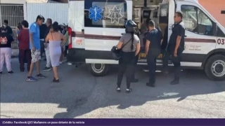 Perro muerde a niño en la cara.png