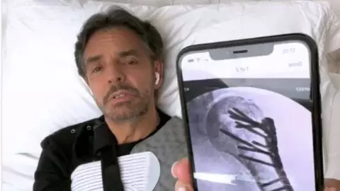 VIDEO Eugenio Derbez revela los detalles de su accidente