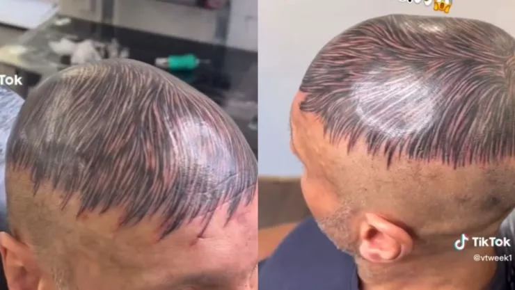 Hombre se viraliza por truco para disimular calvicie