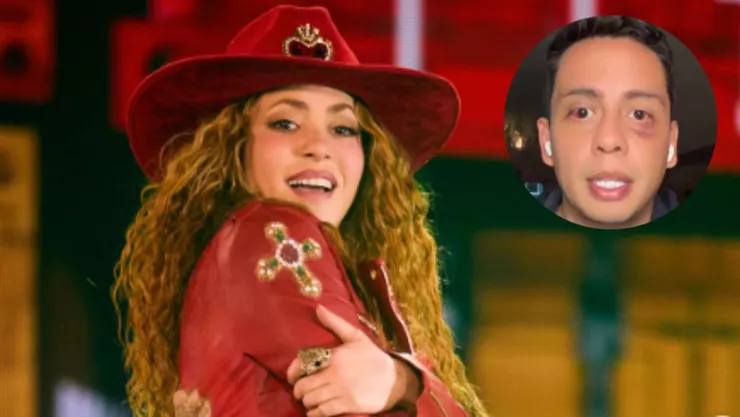 fan-shakira-golpeado-estadio-gnp-seguros-podria-perder-vision-un-ojo.jpg