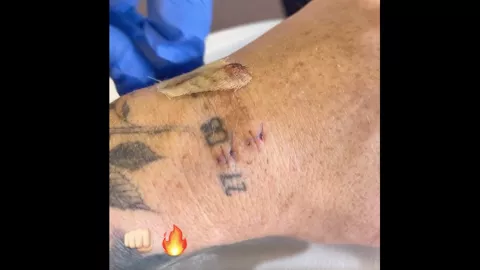 Canelo Álvarez operacion mano izquierda