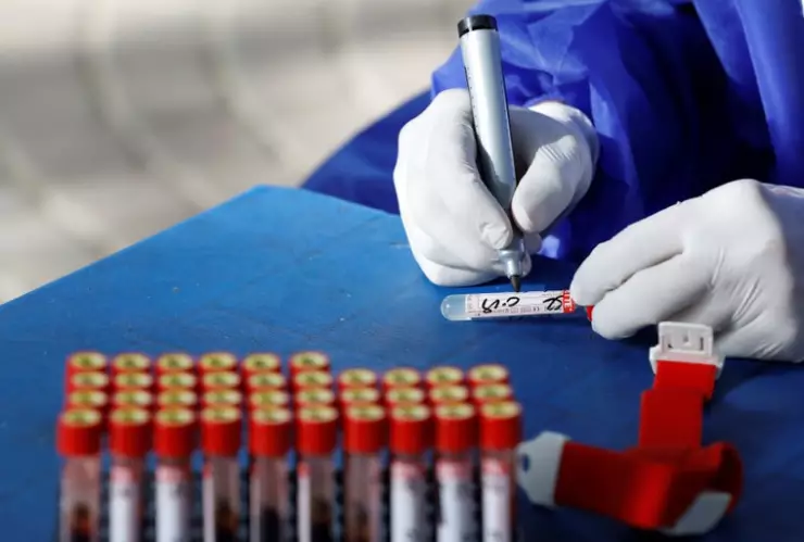 AstraZeneca desarrolla nuevo tratamiento para personas con COVID-19