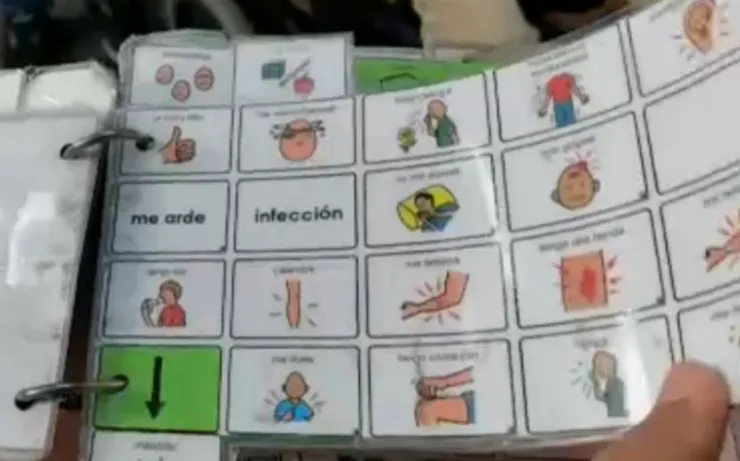 afasia de Broca