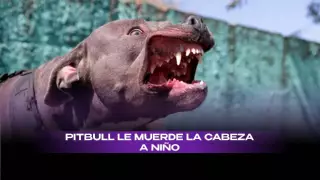 ¡Brutal ataque! Perro le muerde la cabeza a un niño