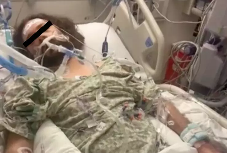 Tras piquete de pulga, amputan manos y pies a un hombre