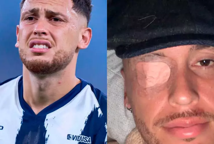 Lucas Ocampos sufre parálisis facial: ¿Cuál es el estado de salud del jugador de Rayados?