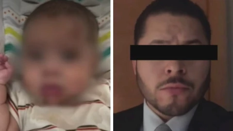 Bebé de 6 meses presenta fracturas por golpes de su padre