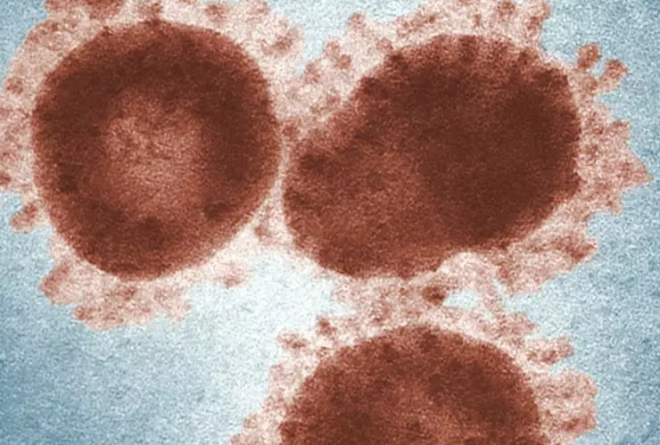 Confirman brote mortal del virus Marburgo: qué es y cuáles son sus síntomas