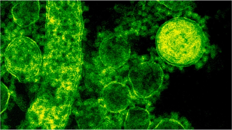 Esto es lo que se sabe de la enfermedad carnívora provocada por una bacteria en Japón