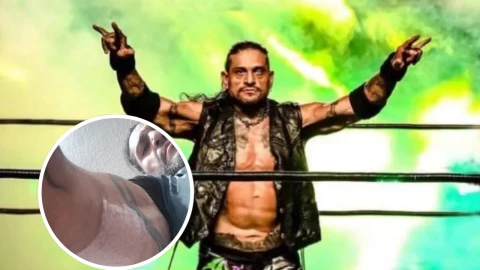 ¿Corre peligro su carrera? Cibernético sufre terrible accidente fuera de la lucha libre