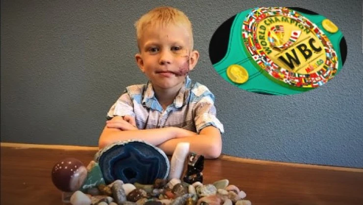 Bridger Walker ni&ntilde;o atacado por un perro