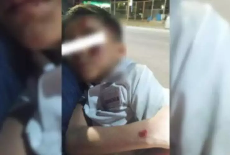 Atropellan a estudiante de seis años