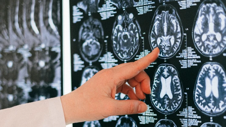 Código cerebro programa enfermedades