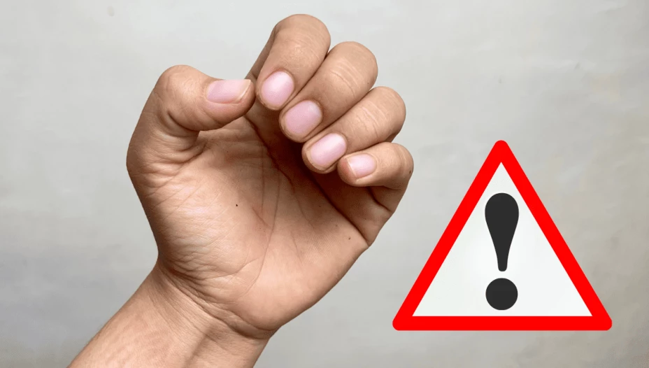 Esto te pasa si te comes las uñas, según los expertos.png