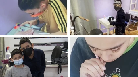 niño uñas operacion hermano (1).jpg