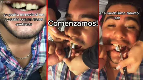 Joven con diente roto