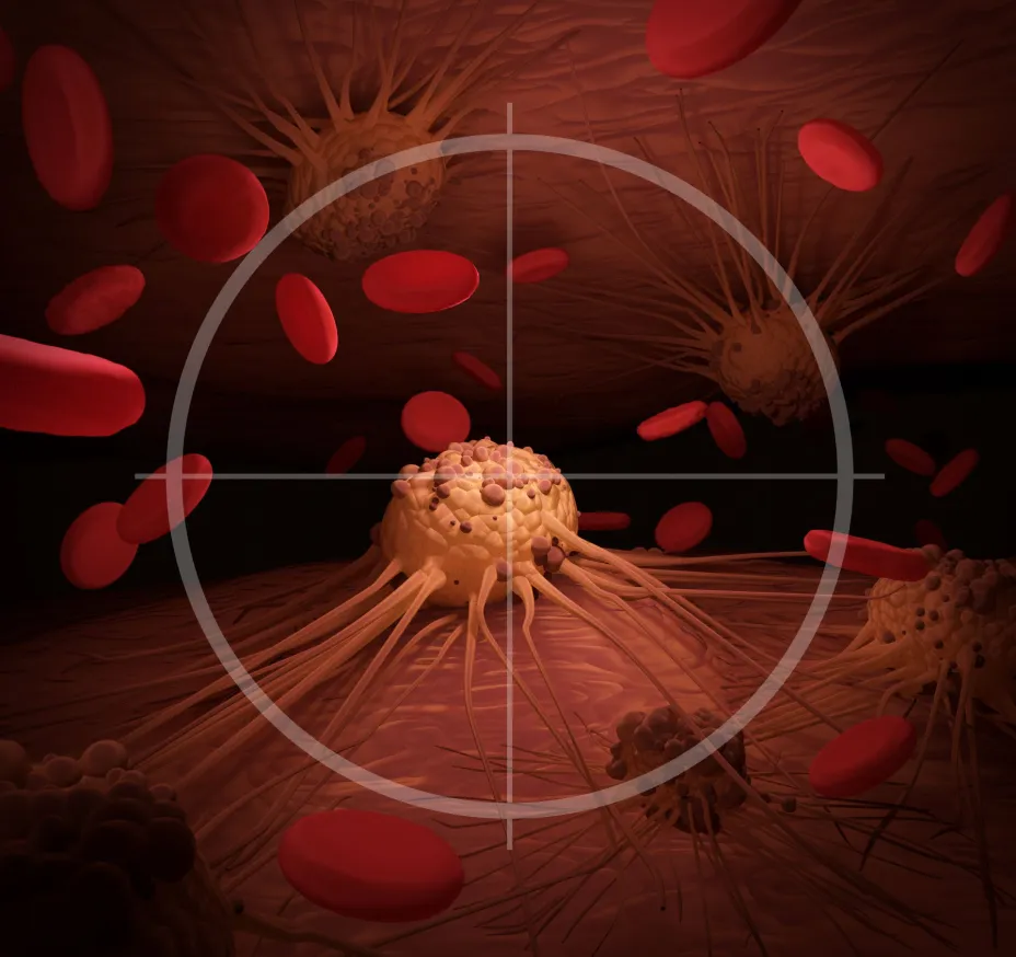 Leucemia William Roberts.jpg