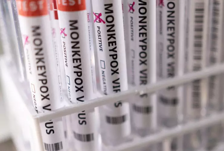 viruela del mono México 252 casos