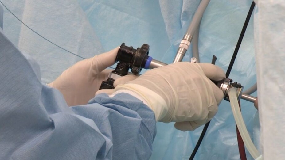 Cáncer-de-pene-Por-qué-es-letal-según-la-UNAM