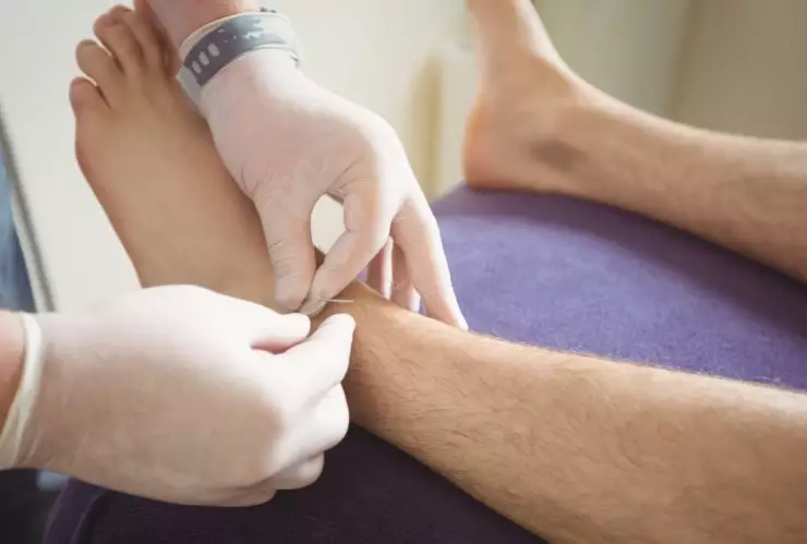 De una herida en el pie a una amputación: así avanzó la infección que afectó a Mike