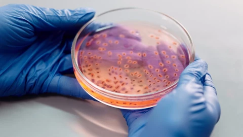 bacterias recipiente estudio