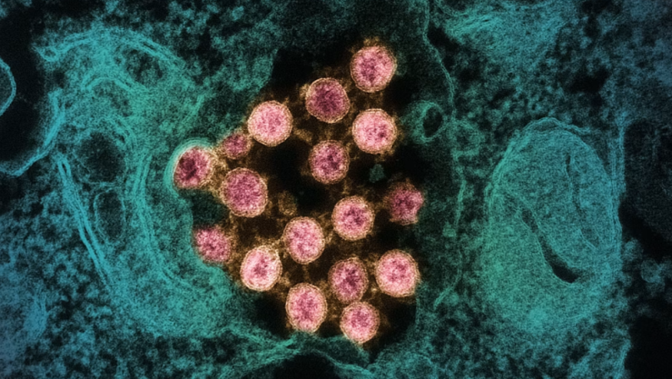 Alerta sanitaria: aumentan los casos de un peligroso virus respiratorio