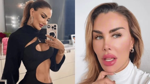 Así se ve Ninel Conde tras sus últimas cirugías su aspecto te sorprenderá.png