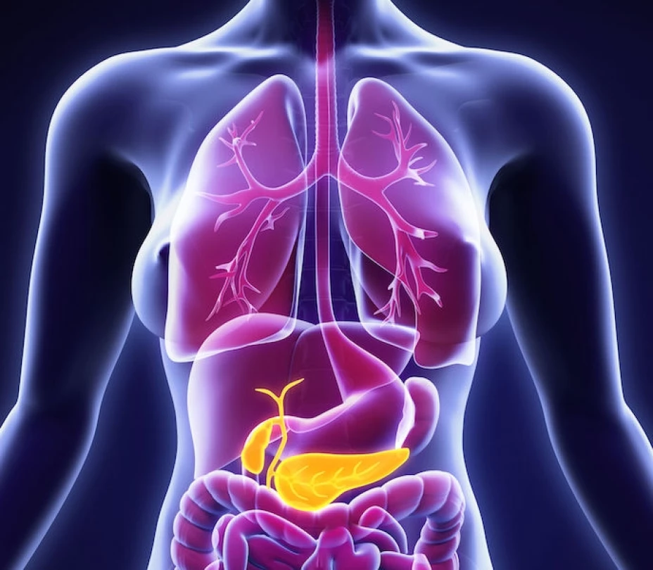 Cáncer de páncreas