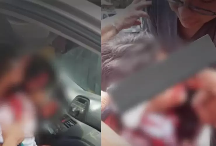 Estado de salud de Miguelito el niño atacado por pitbull en Morelos al salir de la escuela