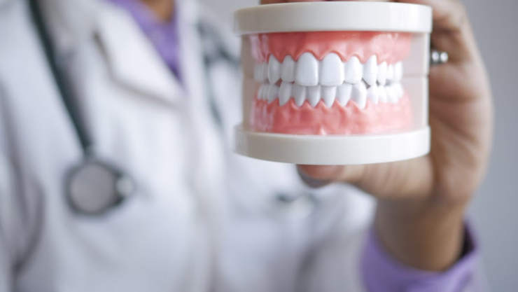 7 alimentos que manchan tus dientes y que deberías evitar después de un blanqueamiento