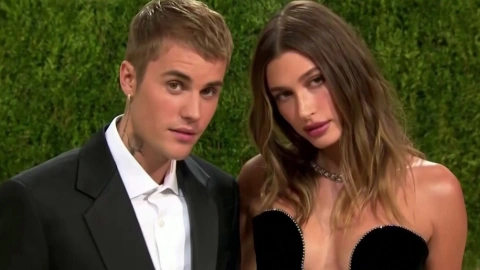 Justin Bieber se recupera tras parálisis facial por síndrome de Ramsay.