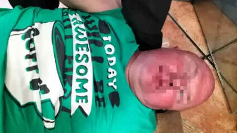 fingió infartos para no pagar la cuenta