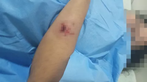 Mujer es agredida con hacha en Choix, Sinaloa