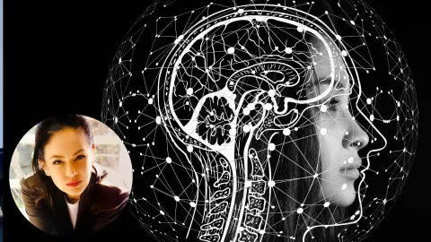 Aneurisma cerebral- Yolanda Andrade