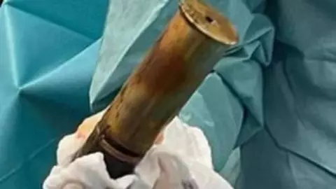 Evacúan hospital porque paciente llegó con bomba en el recto