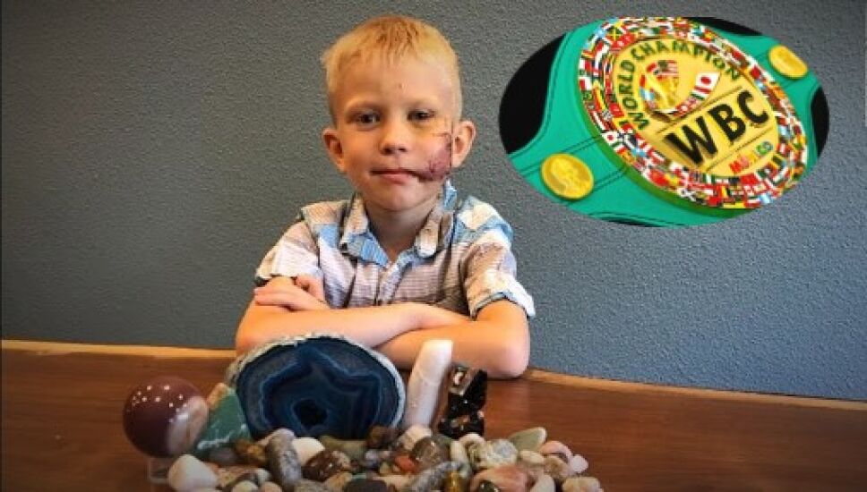 Bridger Walker niño atacado por un perro