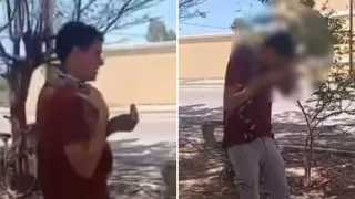 Estudiante es mordido por serpiente en el rostro.jpg