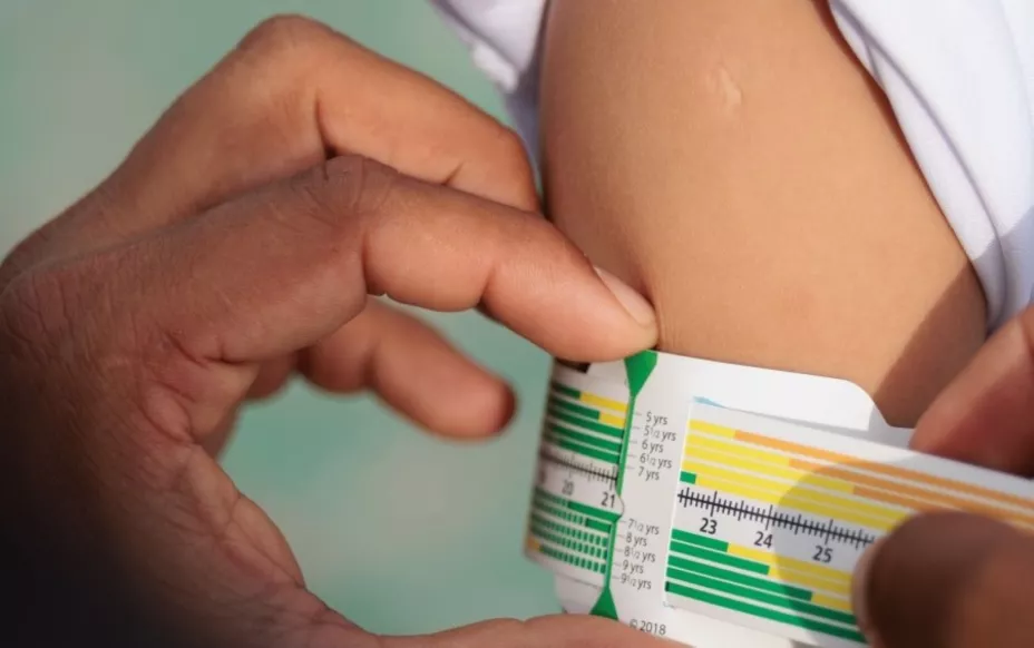 MUAC zscore medición.jpg